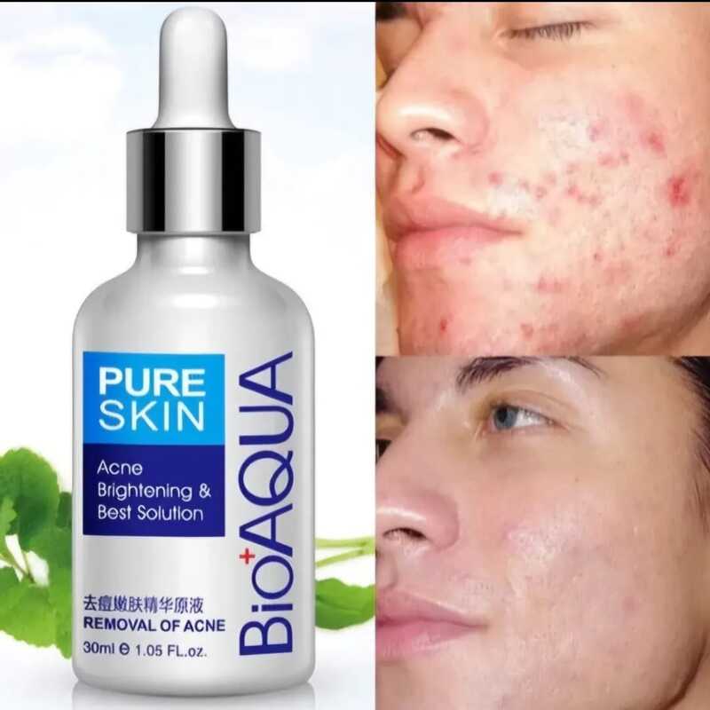 SERUM FACIAL ANTIACNE BIOAQUA
